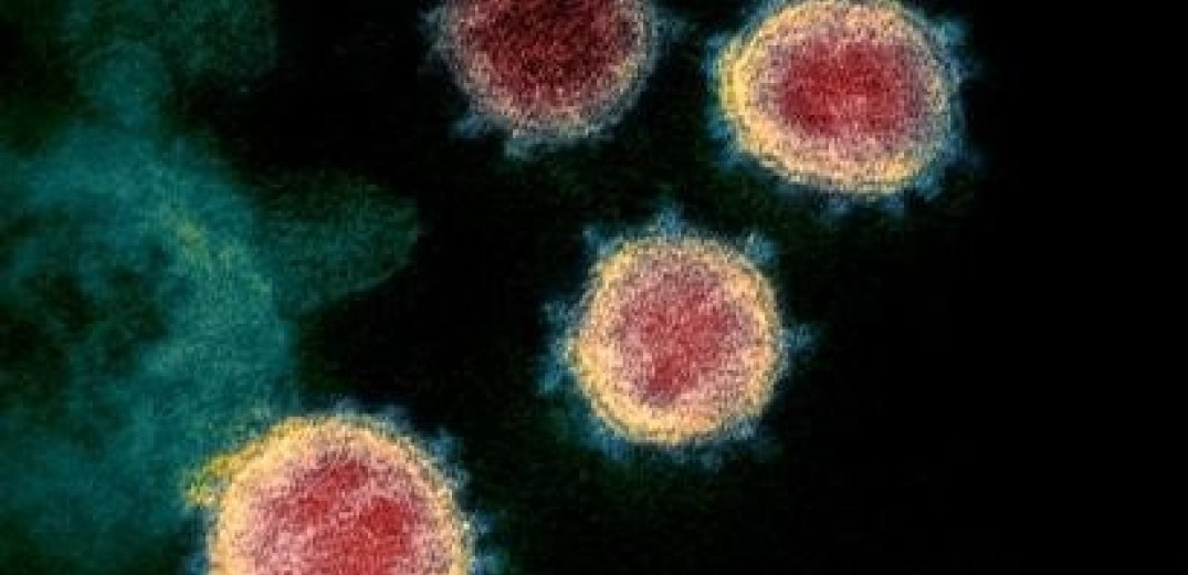 Κορονοϊός: Ανεξάρτητη έρευνα για την προέλευση του ιού ζητά η Αυστραλία