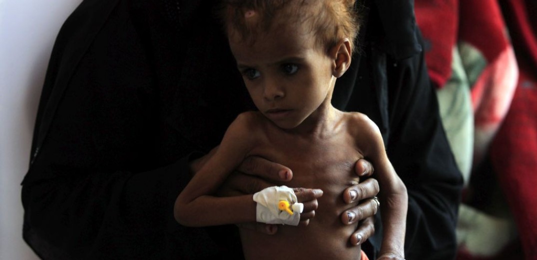 Εκατομμύρια παιδιά κινδυνεύουν με οξύ υποσιτισμό στην Υεμένη - Πεθαίνει 1 παιδί κάθε 10 λεπτά